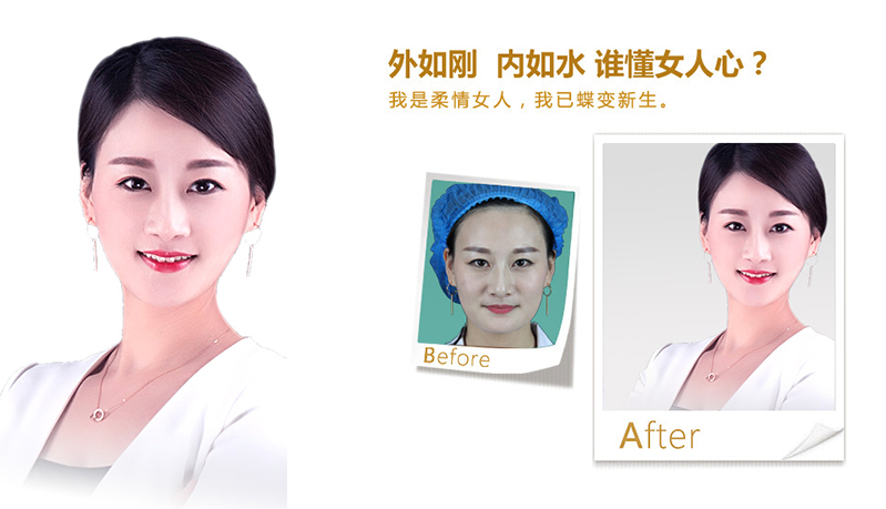 盐城V脸、线雕隆鼻
